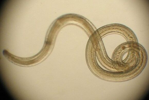 a worm parasite from the human body