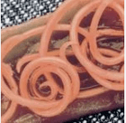 Helminths in people