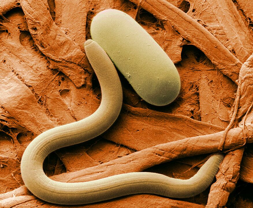 A parasite under the microscope