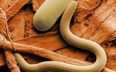 Causes of worm in humans