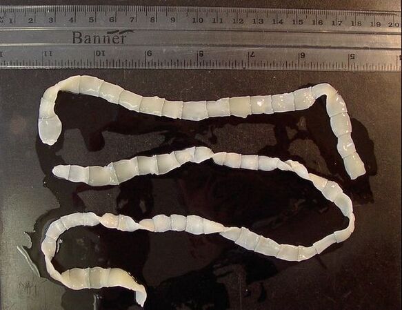 a broad tapeworm from the human body