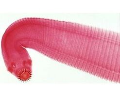 a worm parasite from the human body
