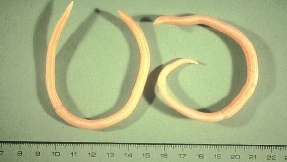 Roundworms are worms that manifest as fatigue and cough.