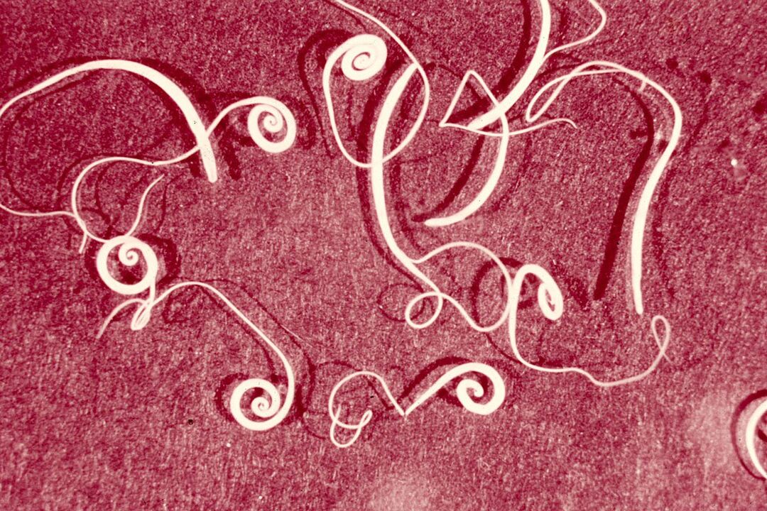 human trichinella