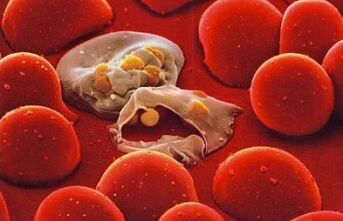 plasmodium malaria in the human body