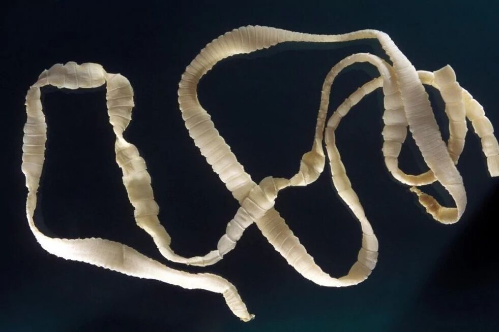 tapeworm, a parasite in the human body